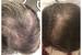 Fast Hair Growth Shampoo