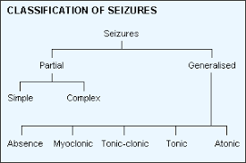 30 Paradigmatic Seizure Classification