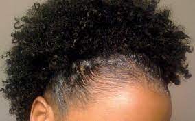 These hairstyles for thinning hair are sizzling hot & make you the envy of every woman you know. Protecting Your Thinning Edges