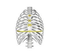 Sternal Fixation System,Medical Device Manufacturers -Double ...