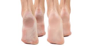 From front to back, these layers are. Hornhaut An Den Fussen Hat Viele Vorteile