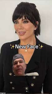 Reviewing Kris Jenners New Facelift., ., ., ., ., #krisjennernewface  #celebrityfacelift #drdorner #dornerplasticsurgery