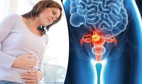 Uterine cancer, or cancer of the uterus (the womb) is the most common cancer of the female reproductive organs. Womb Cancer Symptoms Signs You Could Have Cancer Of The Uterus Express Co Uk