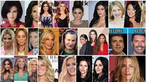 As many before and after photos show, there is no doubt that nicole kidman has undergone plastic surgery. Celebrities Plastic Surgery The Worst Of Lip Augmentation And Face Lift