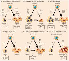 Cancer in the jaw often spreads there from other areas of the mouth or throat. Comparative Pathology Of The Bone Tumor Microenvironment In Download Scientific Diagram