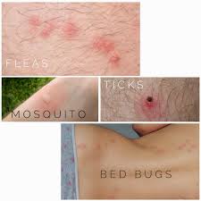 Image result for flea bite
