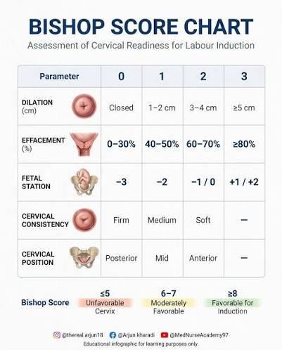 The Bishop Score is a standardized cervical assessment tool used to  evaluate cervical readiness for labor induction by scoring cervical  dilatation, effacement, consistency, position, and fetal station.  Understanding the Bishop Score is