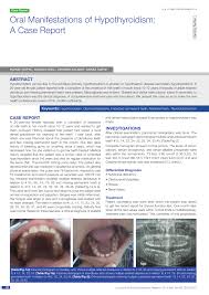 In hypothyroidism, your thyroid doesn't produce enough of these hormones. Pdf Oral Manifestations Of Hypothyroidism A Case Report