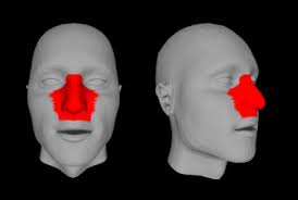 Digital database for nasal prosthesis design with a 3D morphable face model  approach