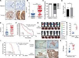 A bone scan is also known as a radionuclide scan, bone scintigraphy, or nuclear medicine bone scan. Nfsjcwky1swifm