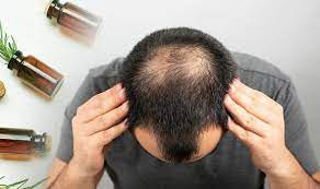 Oil to promote hair growth and boost circulation. Hair Loss Treatment The Fruity Oil Shown To Promote Hair Growth And A Healthy Scalp Sound Health And Lasting Wealth