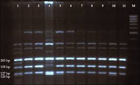 + white + warren cashmere travel wrap. Pcr Rflp Genotyping Of Camel K Casein Gene Promoter With Alui Lane 4 Download Scientific Diagram