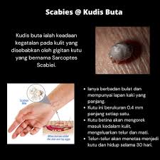 We did not find results for: Tulips Pharmacy ð™Žð™˜ð™–ð™—ð™žð™šð™¨ ð™†ð™ªð™™ð™žð™¨ ð˜½ð™ªð™©ð™– Untuk Facebook
