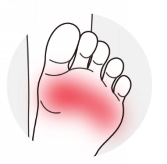 足の指の付け根の痛み | Fit Insole