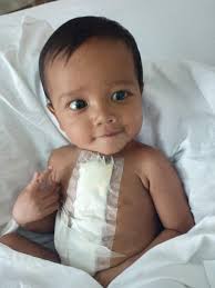 Hi Dear Friends and Fans! I'm very happy today, Good news to all Our 148th  open heart surgery has been success! He is Sudeeshwarn who came in with a  hole in his