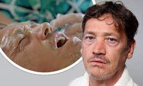 The eastenders actor, 48, looked sombre as he walked down the street. Eastenders Actor Sid Owen S Jaw Is Shattered And Six Teeth Are Knocked Out By A Flying Golf Ball Daily Mail Online