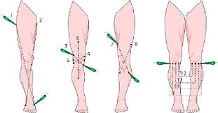 Microcurrent Electrical Therapy Met A Tutorial Page 2