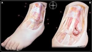During the typical inversion ankle sprain, the foot rolls in. Anatomy Of The Inferior Extensor Retinaculum And Its Role In Lateral Ankle Ligament Reconstruction A Pictorial Essay Springerlink