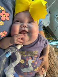 Wrenley's MRI results show brain volume loss