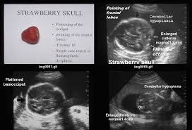 Pin On Mod 5 Ultrasound