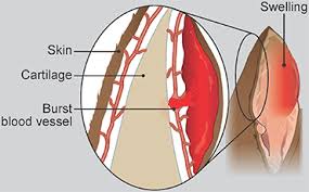 An aural hematoma is a painful thing for a cat or dog. Aural Haematoma In Cats Pdsa