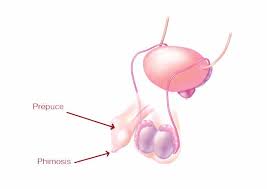Learn more about phimosis and paraphimosis. Phimosis Ses Causes Et Manifestations Soins Naturels Adaptes