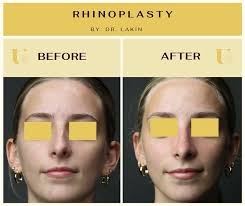 Gregory Lakin, MD...