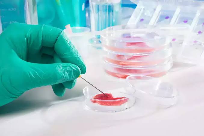 Embryonic Stem Cells have Potential to Cure Chronic As well as autoimmune  diseases