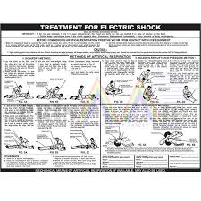 67 Disclosed Electric Shock Treatment Chart Pdf