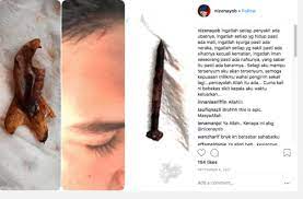 Sebelum ini, pelakon nizen ayob pernah memuatnaik sekeping gambar menunjukkan sebatang paku berkarat dan objek hitam yang tidak dapat dikenal. Pelakon Gerak Khas Meninggal Dunia