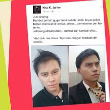 Ubat rambut gugur dan prostat membesar. Khas Untuk Tuan Tuan Yang Serius Ingin Elakkan Kebotakan Dengan Cara Jimat Pantas Ada Masalah Rambut Gugur Atau Mungkin Dah Instagram Posts Instagram Cara