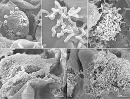 Image result for pseudomonas savastanoi pv nerii oleander symptoms