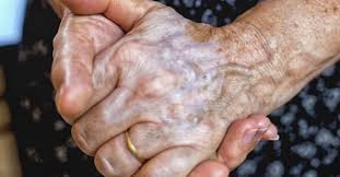 Veins become more visible when blood is forced into them. Hand Veins What Causes Them To Bulge