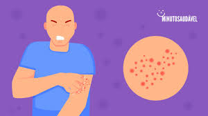 How to care for your skin if you have lupus to help care for your skin during the coronavirus pandemic and beyond, the aad recommends these tips from board. Sarna Escabiose Causa Sintomas Tratamentos Transmissao Ms