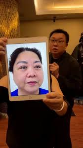 Never too late!!!❤️❤️❤️RHINOPLASTY by The ICON Clinic ICON HOTLINE:  +63-920-908-4266 (SMS, Viber, Whatsapp) #ProudOfMyTruth #IconNation  #icondoll #realpeoplerealresults #thisiswherethemagicbegins ...