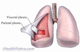 The symptoms of mesothelioma tend to develop gradually over time. Pleural Mesothelioma Definition Causes Symptoms Complications And Cost Surgery Treatment Hospital In India