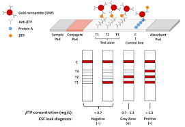 Image result for CSF Protein