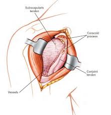 Muscles allow us to move by pulling on bones. Deltopectoral Approach To The Shoulder Full Tutorial 2021 Orthofixar