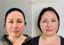 Katie Estes in Monterey, CA