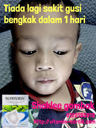 Berikut cara mengobati gusi bengkak dengan cepat dan alami | obat gusi bengkak alami,100% sembuh!gusi bengkak sering terjadi ketika sakit gigi, disini saya. Ubat Gusi Bengkak Kanak Kanak Di Farmasi Rawatan W