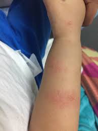 Bedanya kalo boker nahan mules, orgasme nahan rasa geli. Hati Hati Masukkan Anak Dalam Baby Chair Di Tempat Awam Kita Takkan Tahu Kat Situ Berkumpulnya Virus Hfmd Mingguan Wanita
