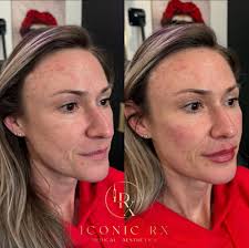 I have some new followers