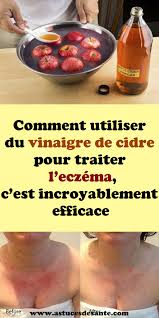 Pin On Remedes Naturels