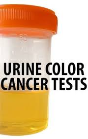 Sadhna verma, arumugam rajesh, srinivasa r. Did You Know