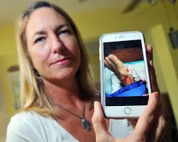 Shark bites in Florida, attack victims: Graphic pictures of wounds