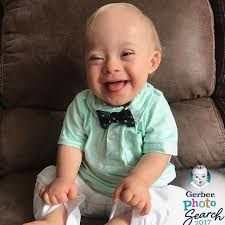 Kenalkan Ini Lucas, si Baby Gerber 2018 yang Menggemaskan