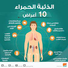 الذئبة الحُمامية الجلدية (cutaneous lupus erythematosus): Ø¥Ù†ÙÙˆØ¬Ø±Ø§Ù Ø§Ù„Ø°Ø¦Ø¨Ø© Ø§Ù„Ø­Ù…Ø±Ø§Ø¡ Ù…Ø±Ø¶ Ù…Ø²Ù…Ù† Ù„Ù‡ Ø£Ø¹Ø±Ø§Ø¶