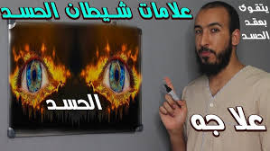 سواد الوجـه خصوصاً وقت الرقية فإذا ما استفرغ السحر أشرق لونه واستنار وجهه. 3hlnpodrvu3ram