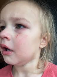 Autism Parents Support Group