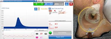 Image result for Cardiac Output